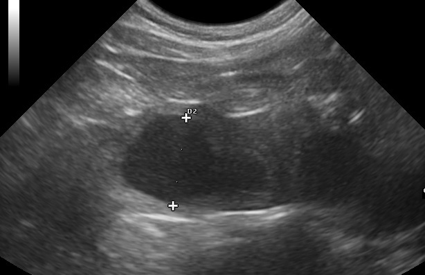 Ultrasound image of the uterus of a queen with pyometra